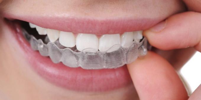 Skřípání zubů: ochranný kryt