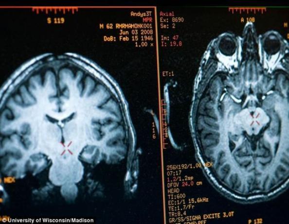 Mozek Mathieu Ricard obraz získaný pomocí MRI