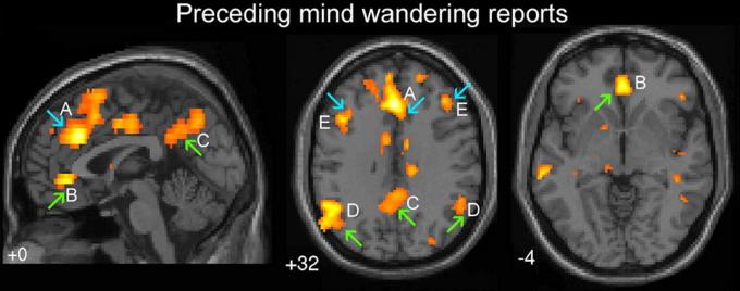Zelené šipky označují oblasti mozku odpovědné za „automatické chování“. Modrá šipka - dále jen „výkonný“ část mozku. A - hřbetní cingulate, B - ventralanya cingulate, C - precuneus mozkové hemisféry, D - bilaterální temporoparietální Junction, E - dorzolaterální prefrontální kortex