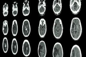 3 vědecké potvrzení úžasných vlastností našeho mozku