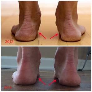 Jak spustit v minimalistické boty změna nohy