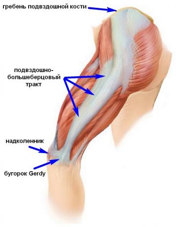 ITBS syndrom