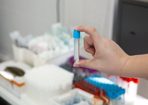 Testy na pohlavně přenosných chorob